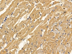 Invitrogen Alcohol Dehydrogenase 1B Polyclonal Antibody 100 &mu;L; Unconjugated:Antibodies,