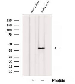 Invitrogen Alcohol Dehydrogenase 1B Polyclonal Antibody 100 &mu;L; Unconjugated:Antibodies,