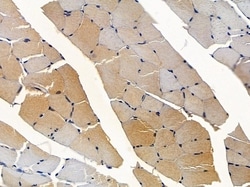 Invitrogen Adiponectin Receptor 2 Polyclonal Antibody 100 &mu;L; Unconjugated:Antibodies,