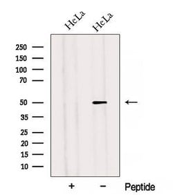 Invitrogen Adiponectin Receptor 2 Polyclonal Antibody 100 &mu;L; Unconjugated:Antibodies,