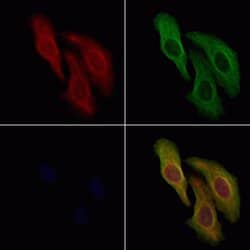 Invitrogen AFAP1L2 Polyclonal Antibody 100 &mu;L; Unconjugated:Antibodies,