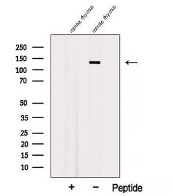 Invitrogen AFAP1L2 Polyclonal Antibody 100 &mu;L; Unconjugated:Antibodies,