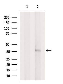 AIPL1 Polyclonal Antibody:Antibodies, Polyclonal
