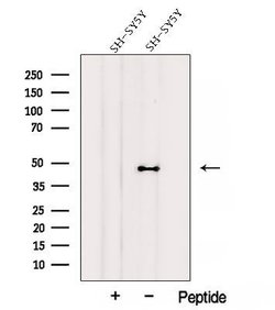 AIPL1 Polyclonal Antibody:Antibodies, Polyclonal