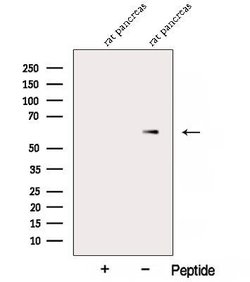 Invitrogen alpha Amylase 2B Polyclonal Antibody 100 &mu;L; Unconjugated:Antibodies,