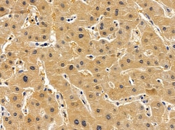Invitrogen ARD1A Polyclonal Antibody 100 &mu;L; Unconjugated:Antibodies,