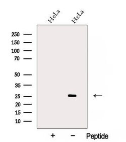 Invitrogen ARD1A Polyclonal Antibody 100 &mu;L; Unconjugated:Antibodies,