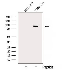 Invitrogen ARHGAP21 Polyclonal Antibody 100 &mu;L; Unconjugated:Antibodies,