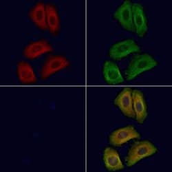 Invitrogen ARL7 Polyclonal Antibody 100 &mu;L; Unconjugated:Antibodies,