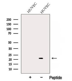 Invitrogen ARL7 Polyclonal Antibody 100 &mu;L; Unconjugated:Antibodies,