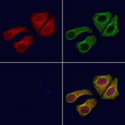 Invitrogen ARL5B Polyclonal Antibody 100 &mu;L | Buy Online | Invitrogen&trade; | Fisher Scientific