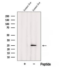 Invitrogen ARL5B Polyclonal Antibody 100 &mu;L | Buy Online | Invitrogen&trade; | Fisher Scientific