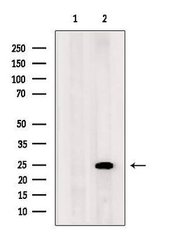 Invitrogen ARL5B Polyclonal Antibody 100 &mu;L | Buy Online | Invitrogen&trade; | Fisher Scientific
