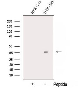 ARMC10 Polyclonal Antibody 100 &mu;L | Buy Online | Thermo Scientific | Fisher Scientific