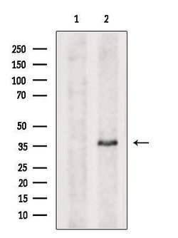 ARMC10 Polyclonal Antibody 100 &mu;L | Buy Online | Thermo Scientific | Fisher Scientific