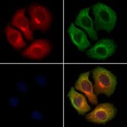ARP2 Polyclonal Antibody:Antibodies, Polyclonal