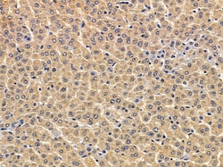 Invitrogen ATL3 Polyclonal Antibody 100 &mu;L | Buy Online | Invitrogen&trade; | Fisher Scientific