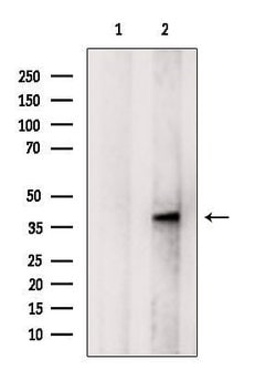 Invitrogen B3GNT3 Polyclonal Antibody 100 &mu;L; Unconjugated:Antibodies,