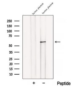 Invitrogen BANP Polyclonal Antibody 100 &mu;L; Unconjugated:Antibodies,