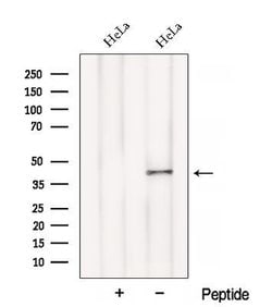 BCAT1 Polyclonal Antibody:Antibodies, Polyclonal