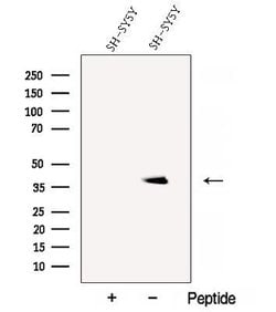 Invitrogen BHLHB5 Polyclonal Antibody 100 &mu;L; Unconjugated:Antibodies,