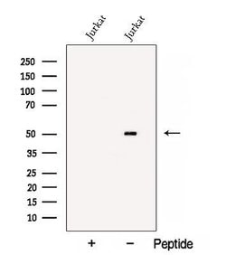 Invitrogen BTN3A1 Polyclonal Antibody 100 &mu;L; Unconjugated:Antibodies,