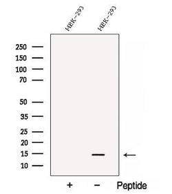 Invitrogen C1orf31 Polyclonal Antibody 100 &mu;L | Buy Online | Invitrogen&trade; | Fisher Scientific