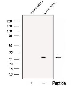 Invitrogen C1orf77 Polyclonal Antibody 100 &mu;L; Unconjugated:Antibodies,