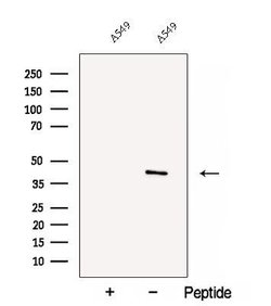 Invitrogen C5orf4 Polyclonal Antibody 100 &mu;L; Unconjugated:Antibodies,