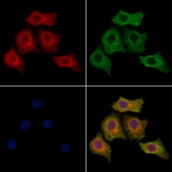Invitrogen CaBP8 Polyclonal Antibody 100 &mu;L; Unconjugated:Antibodies,
