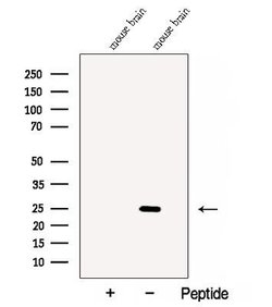Invitrogen CaBP8 Polyclonal Antibody 100 &mu;L; Unconjugated:Antibodies,