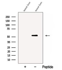 Invitrogen Cathepsin F Polyclonal Antibody 100 &mu;L; Unconjugated:Antibodies,