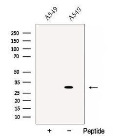 Invitrogen Cathepsin L Polyclonal Antibody 100 &mu;L | Buy Online | Invitrogen&trade; | Fisher Scientific