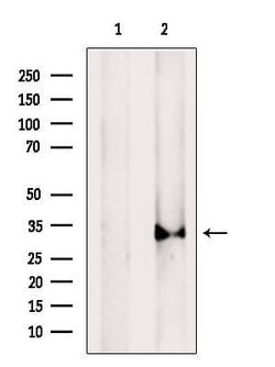 Invitrogen Cathepsin L Polyclonal Antibody 100 &mu;L | Buy Online | Invitrogen&trade; | Fisher Scientific