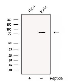 Invitrogen MTGR1 Polyclonal Antibody 100 &mu;L | Buy Online | Invitrogen&trade; | Fisher Scientific