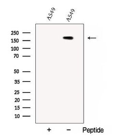 Invitrogen CC2D2A Polyclonal Antibody 100 &mu;L; Unconjugated:Antibodies,