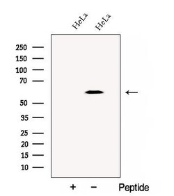 Invitrogen TCP-1 delta Polyclonal Antibody 100 &mu;L | Buy Online | Invitrogen&trade; | Fisher Scientific
