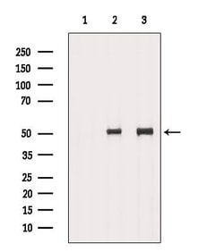 Invitrogen TCP-1 delta Polyclonal Antibody 100 &mu;L | Buy Online | Invitrogen&trade; | Fisher Scientific