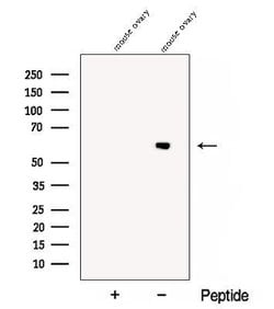 CCT6B Polyclonal Antibody:Antibodies, Polyclonal