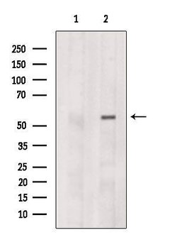 CCT6B Polyclonal Antibody:Antibodies, Polyclonal