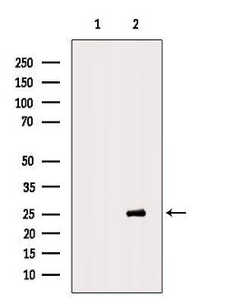 Invitrogen Cdc26 Polyclonal Antibody 100 &mu;L; Unconjugated:Antibodies,