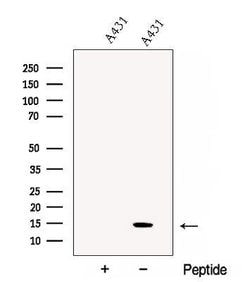 Invitrogen CHCHD10 Polyclonal Antibody 100 &mu;L; Unconjugated:Antibodies,