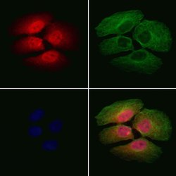 CHMP1A Polyclonal Antibody:Antibodies, Polyclonal