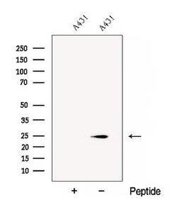 CHMP1A Polyclonal Antibody:Antibodies, Polyclonal