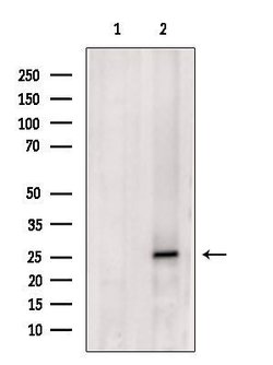 CHMP1A Polyclonal Antibody:Antibodies, Polyclonal