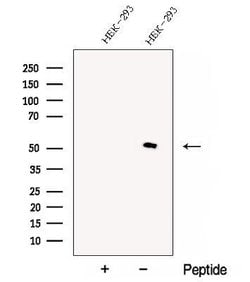 Invitrogen CHMP7 Polyclonal Antibody 100 &mu;L | Buy Online | Invitrogen&trade; | Fisher Scientific