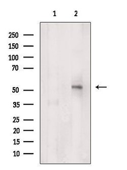 Invitrogen CHMP7 Polyclonal Antibody 100 &mu;L | Buy Online | Invitrogen&trade; | Fisher Scientific