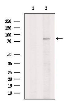 Invitrogen CHMP7 Polyclonal Antibody 100 &mu;L | Buy Online | Invitrogen&trade; | Fisher Scientific