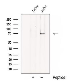 Invitrogen CHST15 Polyclonal Antibody 100 &mu;L | Buy Online | Invitrogen&trade; | Fisher Scientific