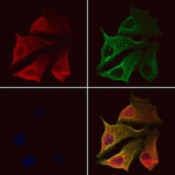Invitrogen Clathrin Light Chain Polyclonal Antibody 100 &mu;L; Unconjugated:Antibodies,